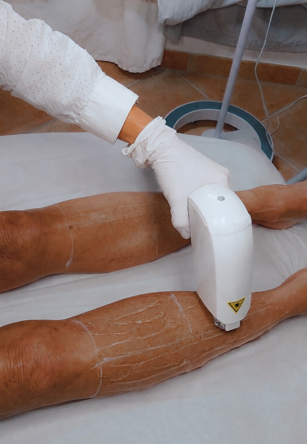 Épilation Laser Diode Attalens